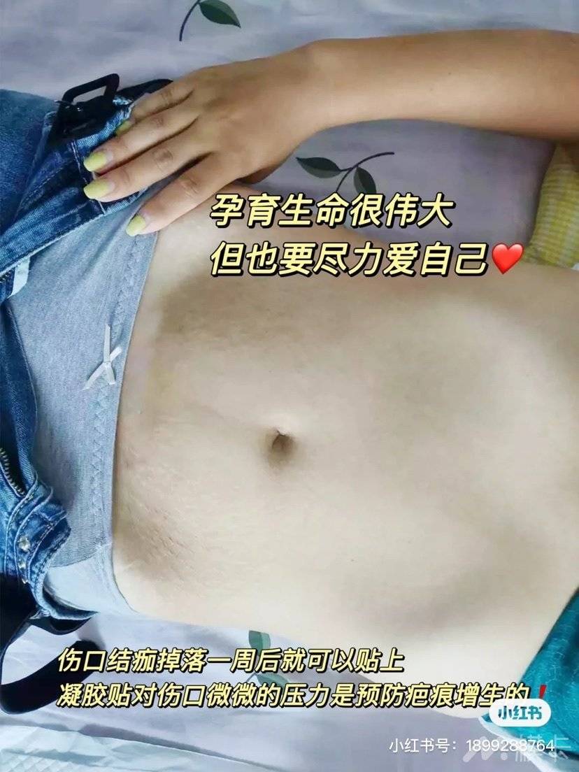 通告图片